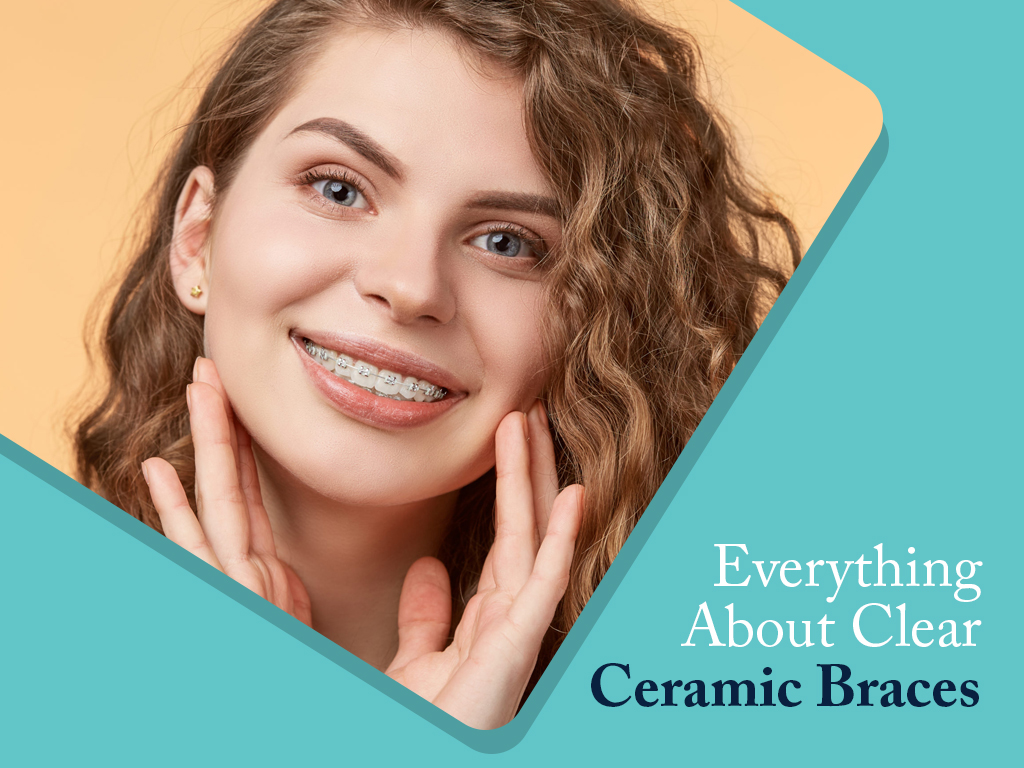 https://www.chatfieldbraces.co.uk/wp-content/uploads/2021/06/Everything-About-Clear-Ceramic-Braces.jpg